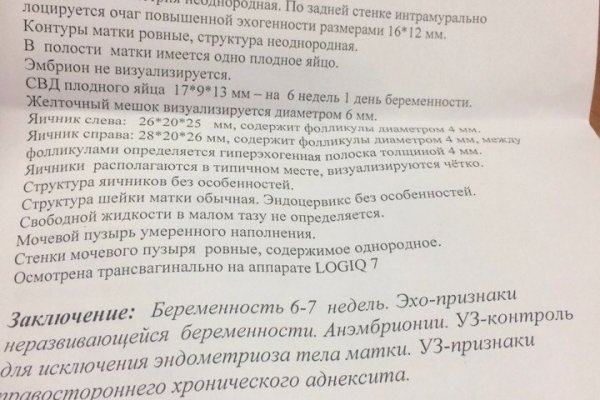 Кракен ссылка pw